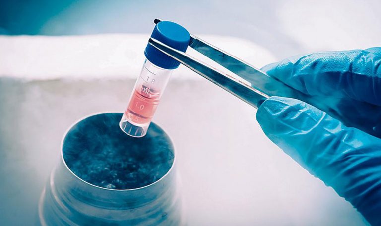 Cryogenic-liquid-nitrogen-portable-container-YDD-series